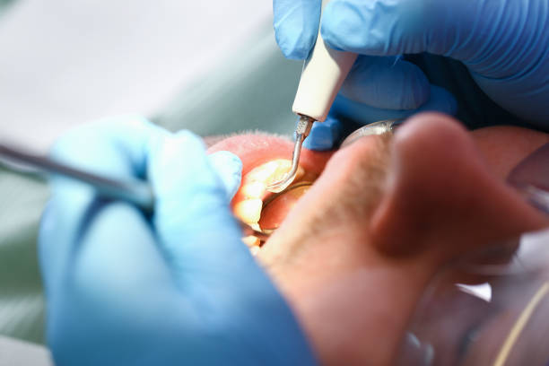 Best Orthodontic Emergency Dentist in English, IN