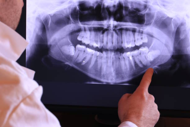 Best Emergency Cosmetic Dentistry in English, IN