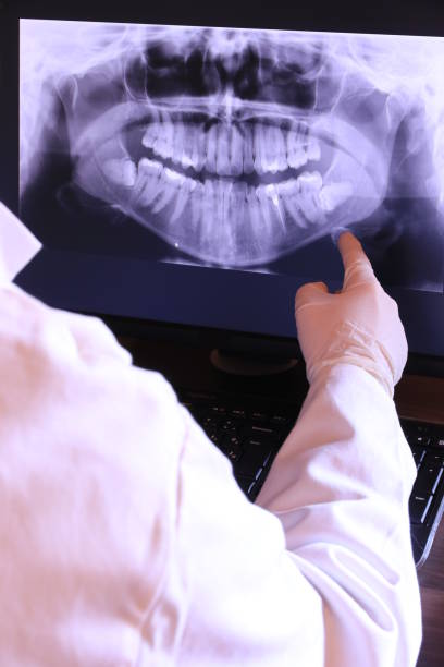 Best Emergency Dental Services for Seniors in English, IN