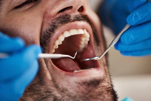 Best Emergency Dentist for Special Needs Patients in English, IN